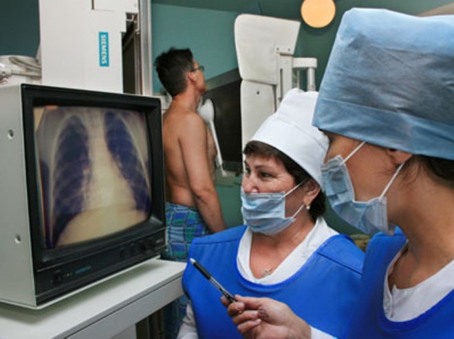Ренгенограмма грудной клетки - один из методов диагностики туберкулеза