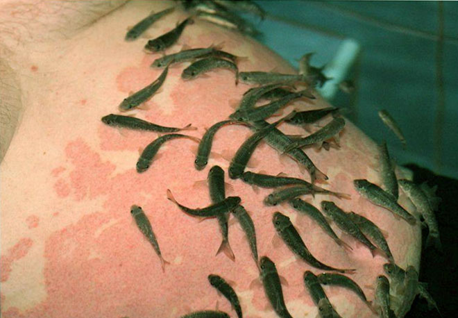  Рыбки-доктора Garra rufa съедают омертвевшие чешуйки кожи