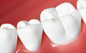 Плазмолифтинг в стоматологии – избавление от многих заболеваний десен и зубов
