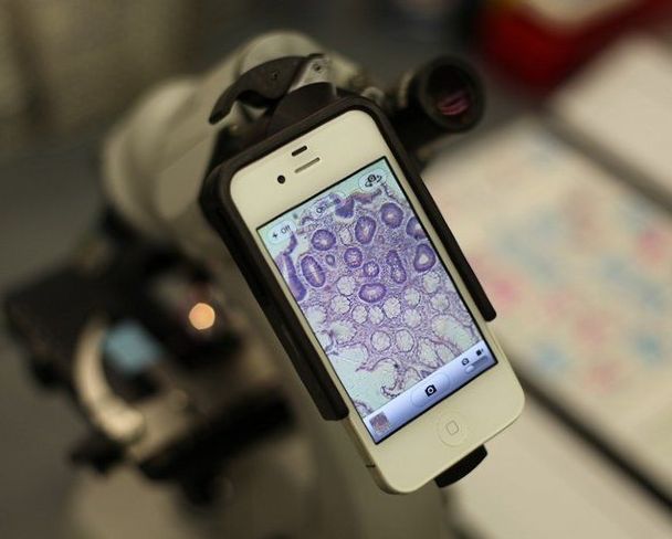 Mikroskop v smartfone