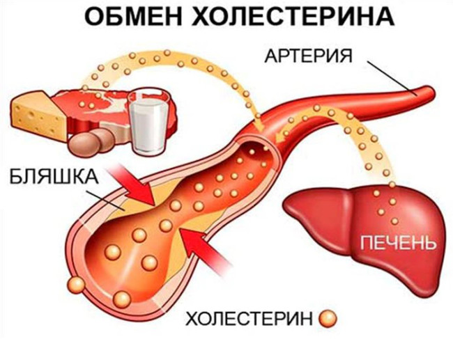 Как снизить холестерин в организме?