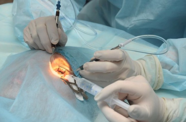 hirurgicheskoe-lechenie-katarakty-i-eg