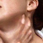 Отек Квинке: признаки, симптоматика, виды лечения