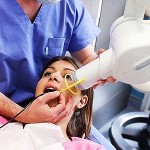 Рентген для зубов