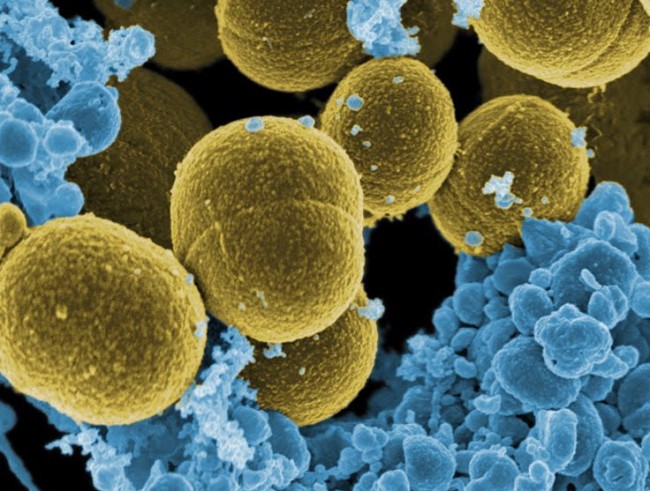 Кишечные бактерии и их профилактика