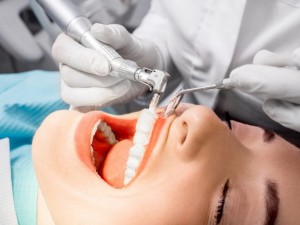 Professionalnaya-chistka-zubov-3
