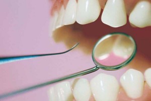 lechenie-zubov01